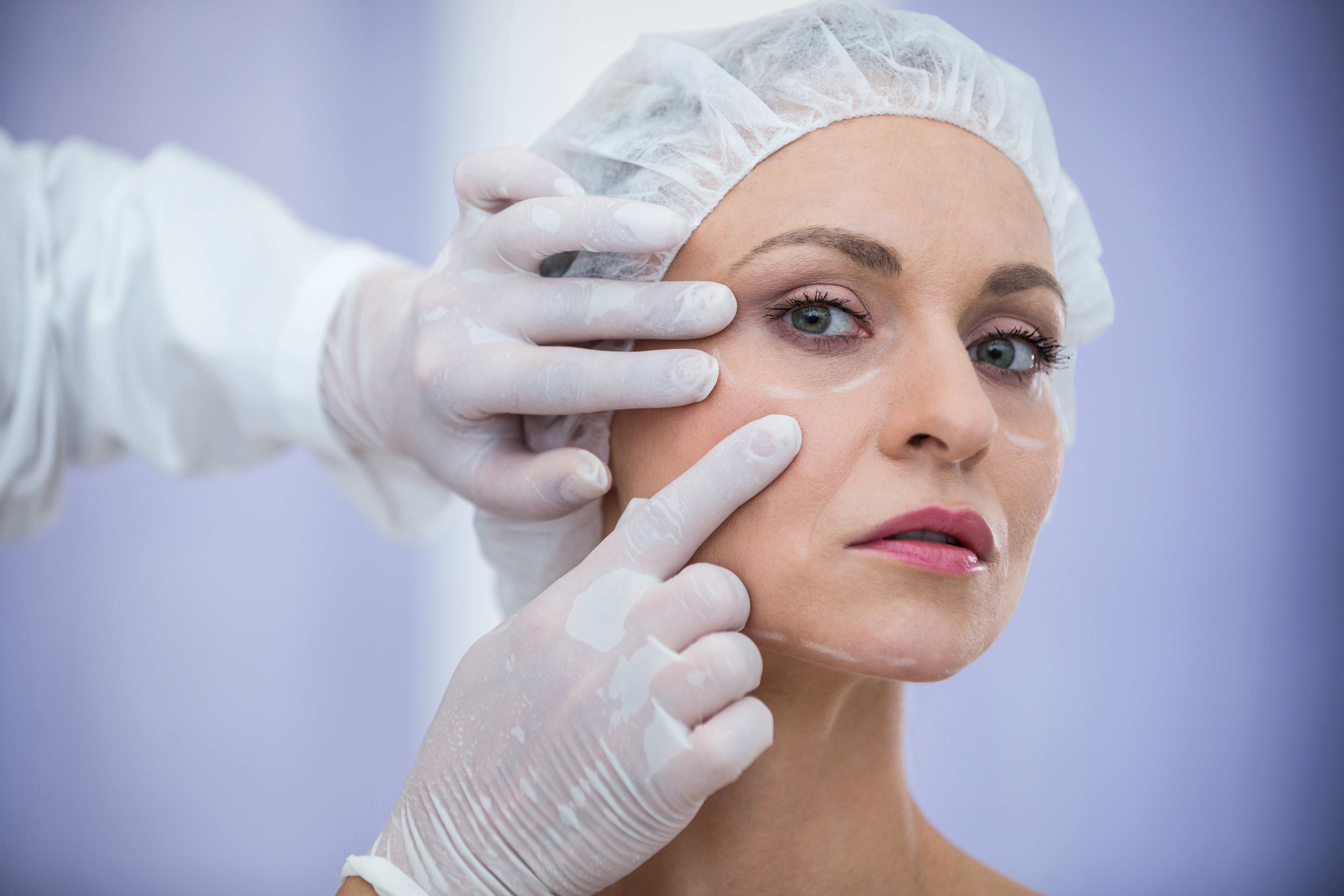 Médico dermatologista examinando o rosto de uma paciente para tratamento cosmético, avaliando a qualidade da pele com luvas médicas